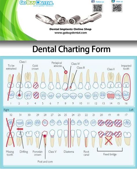 100% ITI Straumann® Implants Compatible，Osstem® TSIII & Hiossen® ETIII Implant Compatible - Quality Dental… | Dental, Dental hygienist school, Dental hygiene school Dental Assistant Study Charting, Dental Charting Abbreviations, Infection Control Dental Assistant, Dental Assistant Cheat Sheet, Dental School Notes, Dental Xrays Tips, Dental Assistant Instructor, Dental Assistant Notes, Dental Assistant Tips