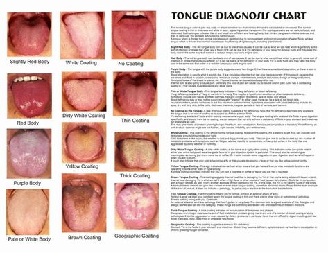 Image Chinese Medicine Tongue Diagnosis, Tongue Color Meaning, Cracked Tongue, Yellow Tongue, Qi Deficiency, Tongue Sores, Remedies For Dry Mouth, Dairy Free Breastfeeding, When To Plant Vegetables