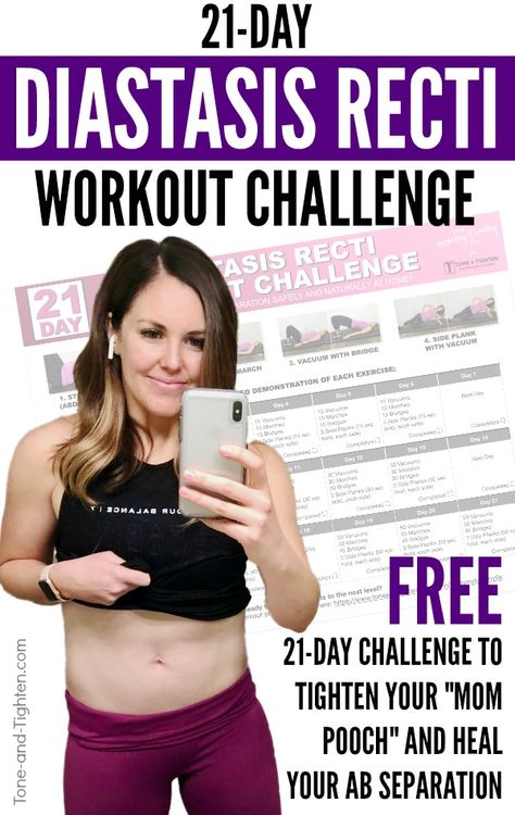 ALL-NEW - "21 Day Diastasis Recti Workout Challenge"! Join me for 21 days as I help with your diastasis recti ab rehab! Diastasis Recti Challenge 21 Days, Fix Diastasis Recti 21 Days, Ab Rehab Exercises, Ab Rehab Post Pregnancy, Heal Diastasis Recti Fast, Postpartum Ab Rehab, Ab Rehab, Postpartum Advice, Pregnancy Abs