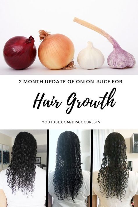 In this video, I share my onion juice for HAIR GROWTH & SHEDDING 2 month update. You will learn about my setbacks, and see the before and after photos of my hair growth. I'll also share how my hair shedding got better than worse! Onion Juice For Hair Growth, Juice For Hair Growth, Juice For Hair, Onion Hair Growth, Onion Juice For Hair, Hair Buildup, Women In China, Onion For Hair, Onion Juice