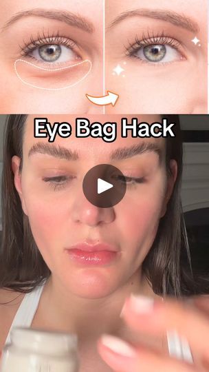 3.5K views · 63 reactions | You ask and you shall receive!  

How to get rid of your eye bags naturally.

Try this and share your before and afters pictures

Everything I'm using plus full tutorials can be found at filterlessera.com 

Xoxo- Sarah

P.S. I love suggestions on what you want to learn next so please drop your suggestions in the comments comments 

#howtoguasha #facialcupping #skincare | Filterless Era Crows Feet Wrinkles, Facial Cupping, After Pictures, Face Yoga, Puffy Eyes, Before And After Pictures, The Joker, Eye Bags, Gua Sha