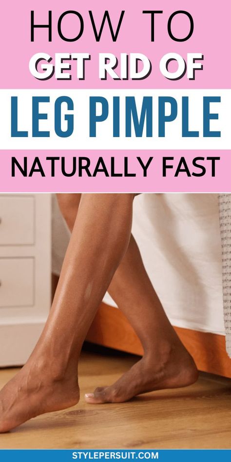 How to Get Rid of Leg Pimples Leg Pimples, Bumps On Legs, Leg Acne, Small Pimples, Calamine Lotion, Strawberry Legs, Heat Rash, Acne Vulgaris, Diy Body Scrub