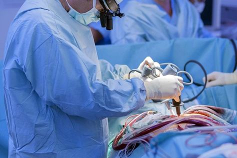 What Is a Quintuple Bypass Surgery? Vertical Sleeve Gastrectomy, Film Thriller, Bariatric Surgeon, Sleeve Gastrectomy, Heart Valves, Sleeve Surgery, Open Heart Surgery, Bypass Surgery, Coronary Arteries