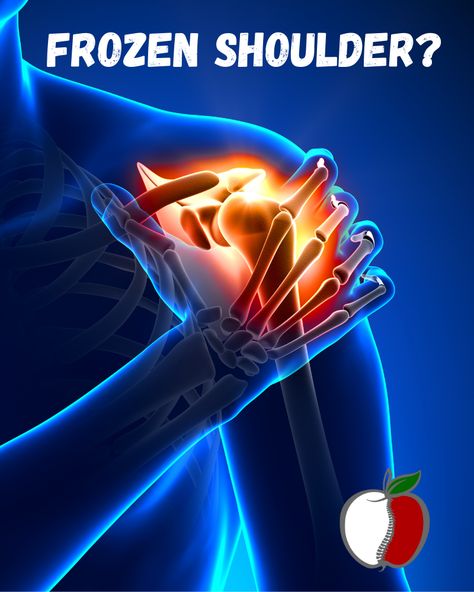 Diagnosing Frozen Shoulder Frozen shoulder is a complex medical condition that can be difficult to diagnose. According to recent studies, it affects up to 20% of the population worldwide. With its various signs and symptoms, diagnosing frozen shoulder requires a comprehensive approach from healthcare professionals Frozen Shoulder Pain, Rotator Cuff Tear, Physical Therapy Exercises, Frozen Shoulder, Rotator Cuff, Heat Therapy, Stretching Exercises, Shoulder Pain, Medical History