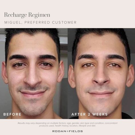 RECHARGE REGIMEN 😊Created for those in their 20's. Their skin was being constantly bombarded with environmental toxins and the increased stress that impacts the quality of the skin. 😊Boost the skins natural defenses and reveal your healthiest-looking skin now and in the future. #detoxyourskin #balanceskintone #boostskindefensesystem https://samanebayatkandi.myrandf.com/our-story/explore-our-regimens?utm_medium=rfsocial&utm_source=pinterest&utm_content=real-results%7Cbefore-afters Real Skin, Life Changing Skincare, Premium Skincare, Skin Aging, Lack Of Sleep, Skin Issues, Rodan And Fields, After Photos, Go For It