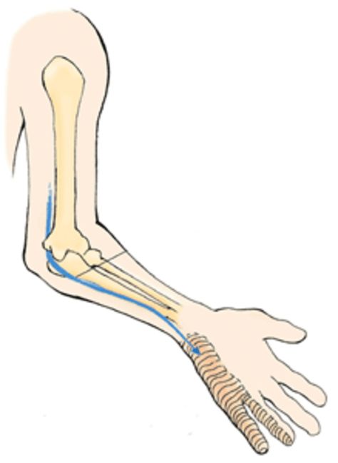 Repetitive stress injuries over the years lead to me having to undergo a common surgical procedure known as a Ulnar Nerve Release. Here's my cautionary tale. Nerve Conduction Study, Ulnar Nerve, Hand Therapy, Carpal Tunnel, Nerve, Chronic Pain, Plexus Products, Over The Years, Give It To Me