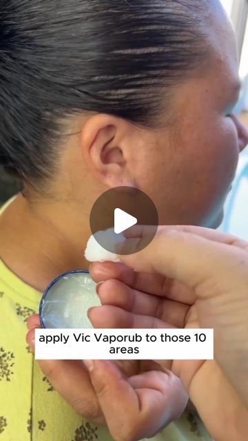 Where To Put Vicks For Stuffy Nose, Vic Vaporub, Vicks Humidifier, Earache Remedies, Vicks Vapor Rub, Vicks Vapor, Vicks Vaporub Uses, Uses For Vicks, Sinus Relief