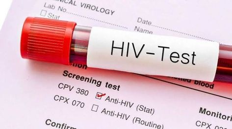 First time in two decades, new HIV subtype found by genetic sequencing https://indianexpress.com/article/lifestyle/health/first-time-in-two-decades-new-hiv-subtype-found-by-genetic-sequencing-6108825/ Hiv Test, Antiretroviral Therapy, Liver Function Test, Living With Hiv, Hiv Positive, Hiv Aids, Progress Report, Aids Hiv, Disease