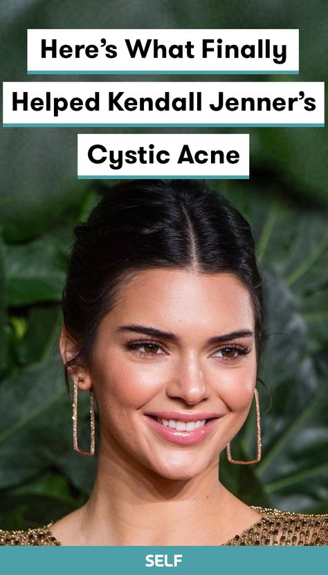 Kendall Jenner Skincare, Kendall Jenner Acne, Kendall Jenner Skin, Kendall Jenner Hair, Jenner Hair, Acne Overnight, Acne Skincare, Acne Skincare Routine, Choppy Hair