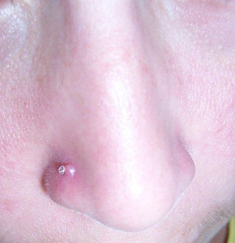 How to get rid of the bump on your nose piercing Nose Piercing Bump, Piercing Bump, Tree Tattoos, The Bump, Body Piercings, Tree Tattoo, Body Modifications, Cartilage Piercing, S Tattoo