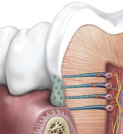 Illustration by Peter Bull showing MOA in a tooth with hypersensitivity for GSK. Explore more work by Peter Bull on the Medical Illustration & Animation Sourcebook online site. #tooth #hypersensitivity #toothsensitivity #dentistry #dentalillustration #patienteducation #illustration #illustrator #dental #sciart Tooth Illustration, Dental Pictures, Kids Dental Health, Teeth Illustration, Dentist Art, Dental Photos, Dental Posts, Dental Videos, Dentistry Student