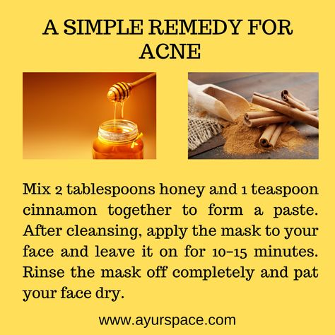 Acne is a chronic, inflammatory skin condition that causes spots and pimples,. It often causes whiteheads or blackheads, and usually appears on the face, forehead, chest, upper back and shoulders. Acne is most common among teenagers, though it affects people of all ages.  Wondering how to get rid of acne fast at home? You can try this remedy. Let's have a look.  #acne #pimples #remedies #ayurveda #health #ayurspace  www.ayurspace.com Remedy For Acne, Get Rid Of Acne Fast, Pimples Remedies, Get Rid Of Acne, Rid Of Acne, Skin Condition, Acne Remedies, How To Get Rid Of Acne, Skin Conditions