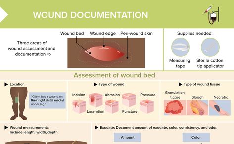 Find a step-by-step guide to wound documentation here, including a downloadable cheat sheet and a wound documentation sample ➜