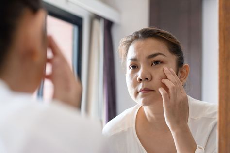 Calcium Deposits on the Face: Symptoms and Causes Calcium Deposits On Face, Natural Wrinkle Reducer, Home Remedies For Wrinkles, Calcium Deposits, Skin Growths, Skin Dryness, Face Wrinkles, Laser Therapy, Skin Disorders