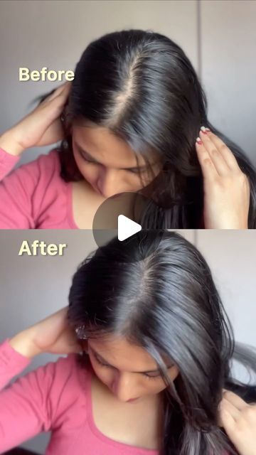 _chetana♡ on Instagram: "Magic😍 @tryhappyheads 🎀 comment ‘link’ to get link in your dm !! . .  [ hair thinning solution, hair powder, hair line powder, happy heads, tryhappyheads, hair patch, ]   #viralreels #hair #hairpowder #hairtransformation #reels #fashion" Hair Powder For Volume, Hair Volume Powder, Hair Line, Hair Powder, Hair Thinning, Hair Fibers, Volume Hair, Hair Transformation, Hair