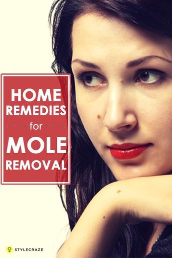 24 Effective Home Remedies For Mole Removal Dark Mole, Remove Moles, Red Moles, Thick Hair Remedies, Skin Moles, Skin Growths, Face Tips, Mole Removal, Home Remedies For Acne