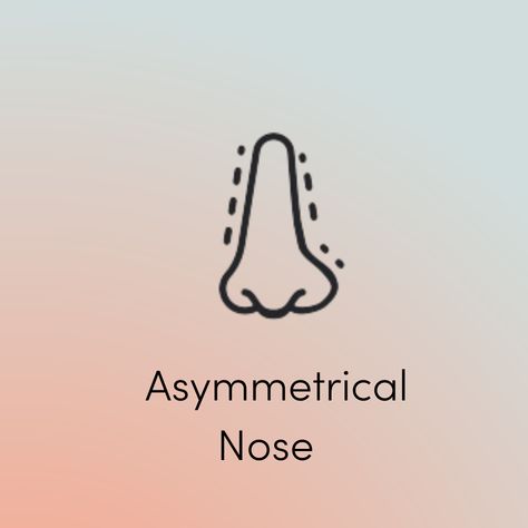 Asymmetrical Nose, Quick Saves