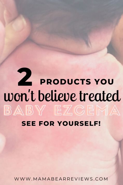 2 items to treat baby acne and ezcema #babyacne #babyacnetreatment #babyezcema Excema Remedies Diy, Breastmilk For Excema, Baby Acne Remedy, What Helps Excema, Essential Oils For Excema For Kids, Baby Excema, Rash On Face, Pregnancy Chart, Itchy Face