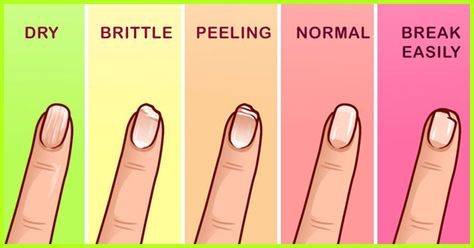 Jealous of your friends having gorgeous long fingernails? Take these 5 foods and follow these methods to make your nails grow faster and stronger naturally. Nail Falling Off, Grow Nails Faster, Long Fingernails, How To Grow Nails, Nail Growth, Strong Nails, Nail Health, Womens Nails, Yellow Nails