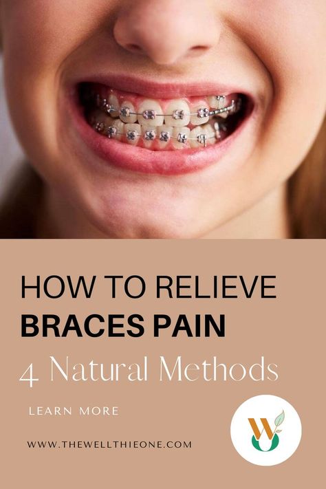 How to Relieve Braces Pain – 4 Natural Methods After Braces, Braces Pain, Getting Braces, Natural Pain Relievers, Essential Oils For Pain, Teeth Braces, Natural Pain Relief, The Liver, Oral Care