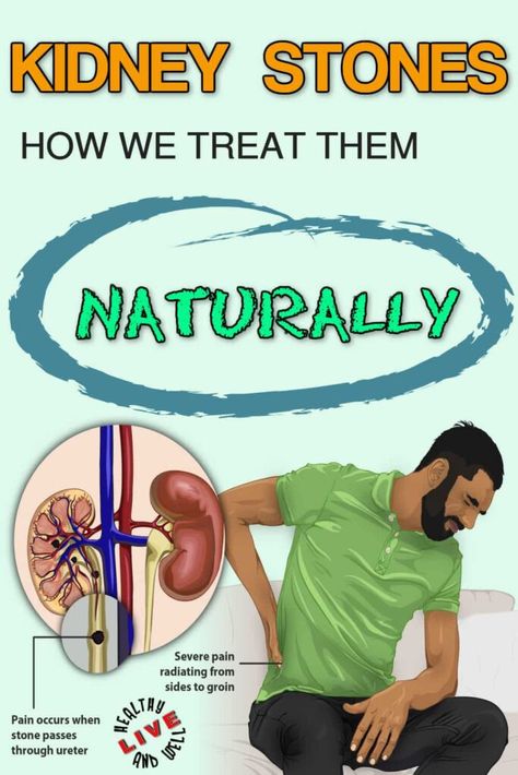 Kidney Stone Pain Relief, Improve Kidney Function, Kidney Pain, Kidney Stone, Healthy Kidneys, Kidney Function, Kidney Diet, Health Hacks, Live Healthy