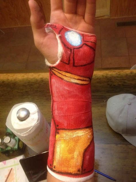 "I broke my wrist, and got bored of the plain ole cast. So I decorated it..... Iron Man style." Broken Arm, E Mc2, Dc Movies, The Perfect Guy, Geek Out, Avengers Assemble, The Villain, Look At You, Guardians Of The Galaxy