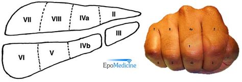 Couniaud divided liver into 8 functional segments, each of which is supplied by… Liver Segments Ultrasound, Liver Segments, Ultrasound School, Liver Anatomy, Abdominal Aorta, Ultrasound Sonography, Medical Ultrasound, Medical Mnemonics, Diagnostic Medical Sonography