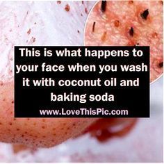 If You Wash Your Face With Coconut Oil And Baking Soda THIS Is What Happens To Your Face... Coconut Oil And Baking Soda, Health Coconut Oil, Baking Soda Face, Baking Soda Benefits, Coconut Oil Skin Care, Coconut Oil Uses, Coconut Oil For Skin, Oil Uses, Skin Cleanser Products