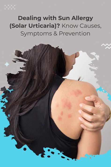 Skin Problems in Summer - Sun Allergy Sun Allergy, Hair Academy, Sick Remedies, Allergy Remedies, Red Patch, Skin Condition, Allergy Symptoms, Skin Conditions, Skin Care Tips