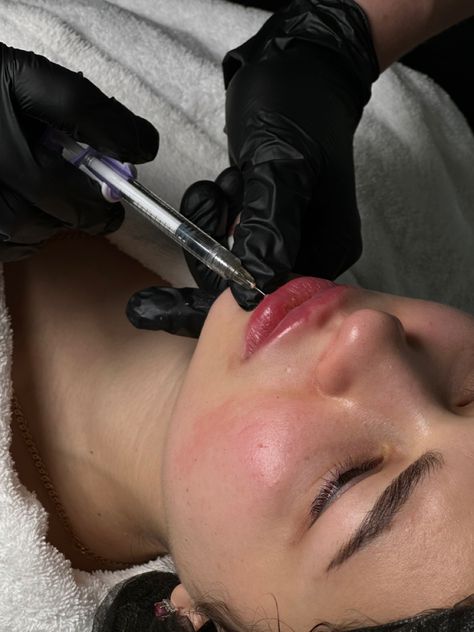 Cosmetic Nursing Aesthetic, Cosmetic Nurse Injector Aesthetic, Botox Nurse Aesthetic, Botox Aesthetic Photography, Lip Injections Aesthetic, Dermaplane Aesthetic, Plastic Surgeon Aesthetic, Injector Photoshoot, Armonizacion Facial