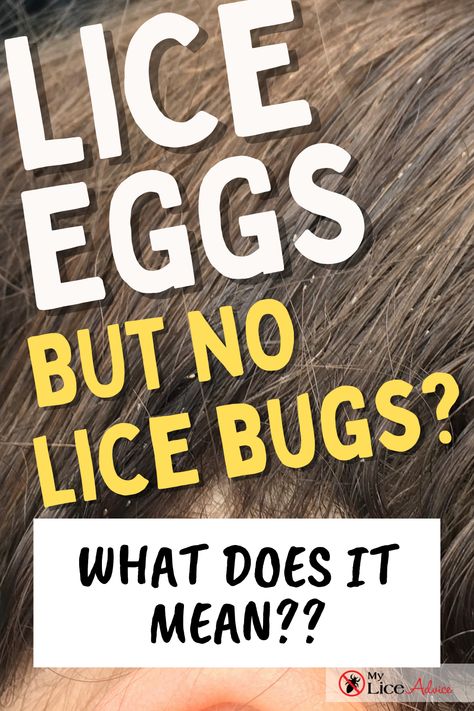 Learn the 3 reasons you can have lice without lice eggs and what to do about it! If you found a lice bug in your child’s hair, but you’re not finding any lice eggs or nits, then this is the video for you. Is it possible to have lice and no nits? Yes, it is. #myliceadvice # lice #liceeggs #nits How To Get Rid Of Lice Eggs, How To Get Rid Of Hair Lice Fast, How To Remove Lice Eggs From Hair, Lice And Nits Remedies, Prevent Lice With Essential Oils, Best Way To Get Rid Of Lice And Nits, Lice Nits, Hair Lice, Lice Eggs