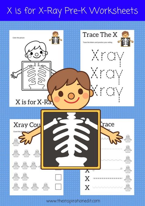 X For Xray Preschool, X Is For Xray Craft Preschool, X Worksheets For Preschool, Letter X Crafts, Counting Activities Preschool, Pre K Worksheets, Preschool Letter, Kids Printables, Free Preschool Worksheets