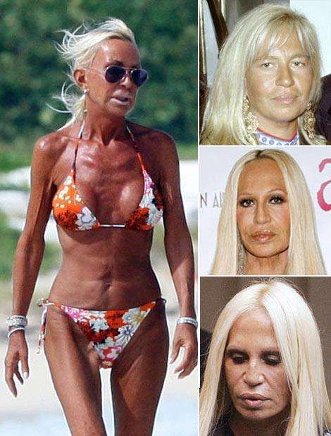 Donatella Versace Plastic Surgery, Plastic Surgery Facts, Bad Plastic Surgeries, Plastic Surgery Gone Wrong, Hairstyles Hoco, Fashion Designers Famous, Celebrity Plastic Surgery, Summer Dresses For Wedding Guest, Donatella Versace