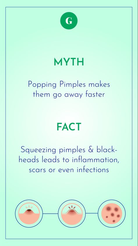 Skin Care Fun Facts, Skincare Fun Facts, Skincare Topics, Myth Fact, Aesthetic Center, Small Business Instagram, Skin Advice, Journal Books, Business Instagram