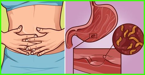 Constant Nausea, Gum Inflammation, Ibs Diet, Stop Acid Reflux, Intestinal Parasites, Parasite Cleanse, Probiotic Drinks, Great Health, Stomach Issues