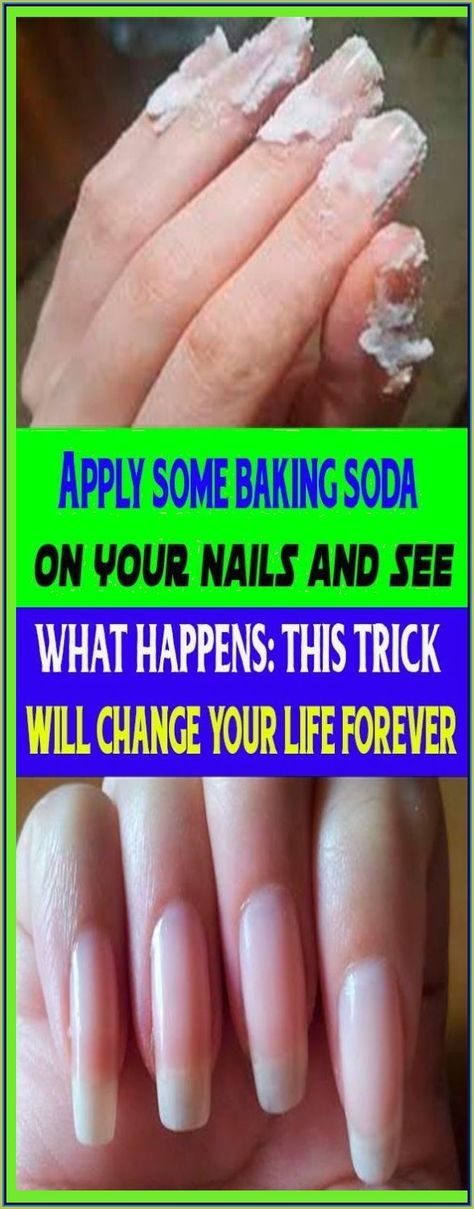 APPLY SOME BAKING SODA ON YOUR NAILS AND SEE WHAT HAPPENS: THIS TRICK WILL CHANGE YOUR LIFE FOREVER Soda Nails, Baking Soda Nails, Crystal Makeup, Cleaning Advice, Coconut Health Benefits, Baking Soda Shampoo, Creating A Newsletter, Face Wrinkles, When You Sleep