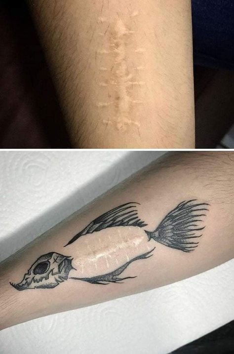 Tattoo ideas Tattoo Over Scar, Scar Cover Up, Tattoos To Cover Scars, Body Positivity Art, Scar Tattoo, Tatuaje A Color, Hand Tattoos For Guys, Tattoo Cover-up, Cover Up Tattoo