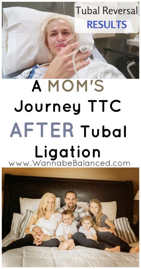 Birth Control | Trying to Conceive After Tubal Ligation Reversal - Wannabe Balanced Mom Fallopian Tube Blockage Natural Remedies, Pregnancy After Tubal, Conceive Twins Naturally Tips, Blocked Fallopian Tubes, Tubal Reversal, How To Get Pregnant After Birth Control, Fallopian Tubes, Natural Fertility, Trying To Get Pregnant