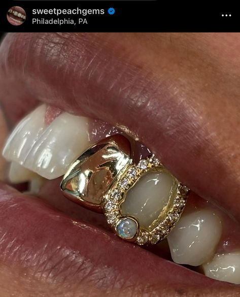 Grillz For Females Bottom Teeth, Girly Grillz Gold Grill, Custom Grillz For Women, Grillz With Letters, Feminine Grillz, Grill Inspo Girl, Grillz Bottom Teeth, Gold Tooth Women, Grill Ideas Teeth