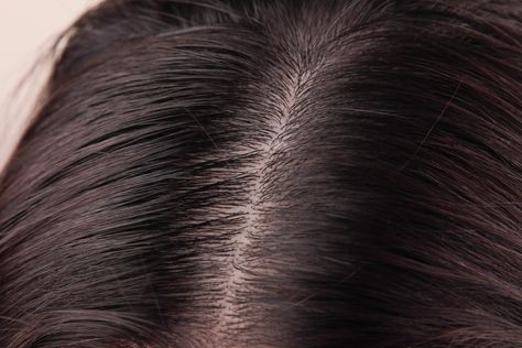 How to Clean Sebum From the Scalp Natural Hair Removal Remedies, Clean Scalp, Thick Hair Remedies, Oily Scalp, Coconut Oil Hair, Hair Control, Scalp Health, Body Hair Removal, Grow Hair Faster