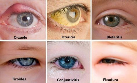 Eye Health Facts, Optometry Education, Eye Medicine, Tissue Biology, Medical Assistant Student, Eye Facts, Eye Anatomy, Medical Student Motivation, Medical Student Study