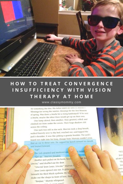 Vision Therapy Exercises, Vision Therapy Activities, Convergence Insufficiency, Visual Perceptual Activities, Visual Processing, Vision Therapy, Eyes Game, Eye Exercises, Low Vision