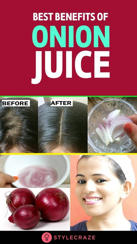 Red Onion Benefits, Garlic For Hair Growth, Juice For Hair, Onion Oil For Hair, Onion Benefits, Onion Juice For Hair, Hair Grow Faster, Garlic Juice, Onion For Hair