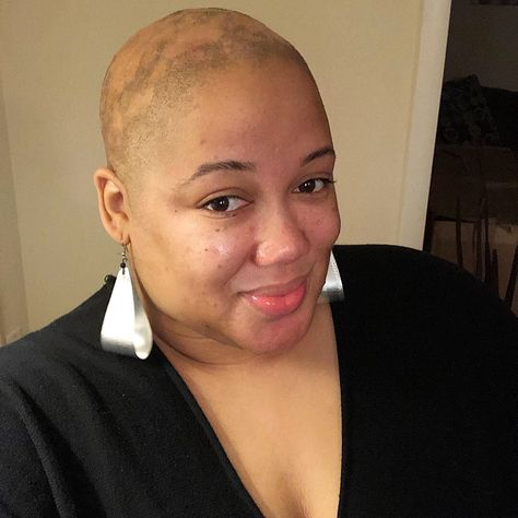 Bald Head Black Women, Alopecia Hairstyles Black Women, Scarring Alopecia, Bald Beauty, Buzz Cut Women, Alopecia Awareness, Alopecia Hairstyles, Bald Head Women, Bald Look