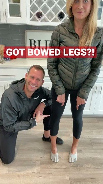 How To Fix Your Bowed Legs! #shorts #kneepain #exercisetips Bow Legs Correction Exercise, Bow Legged Correction, Knee Problem, Bow Legged, Knee Pain, Leg Workout, Fix You, Fitness Tips, Health