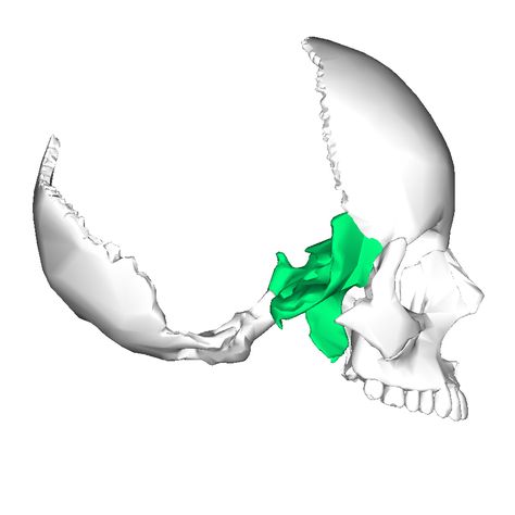 Sphenoid bone : forms the anterior part of the base of the cranium . Central wedge that articulate with all other cranial bones Cranial Bones, Cranial Sacral Therapy, Sphenoid Bone, Polarity Therapy, Body Bones, Craniosacral Therapy, Xray Tech, Human Anatomy Art, Health Heal