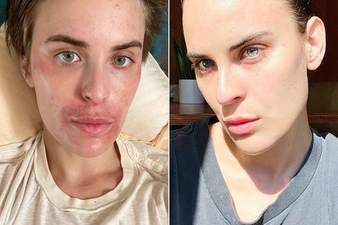 Tallulah Willis Gets Candid About Her Skin Struggles—and Says She's 'Truly Proud' of Her Progress Tallulah Willis, Fantasy Fiction Books, Spooky Places, Demi Moore, Attitude Of Gratitude, Bruce Willis, Progress Pictures, Cute Family, Esthetician