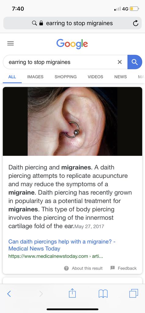 Daith And Tragus Piercing Together, Daith Piercing Infection, Daith And Snug Piercing, Daith Piercing Video, Daith Piercing Aftercare, Daith Piercing, Video New, Acupuncture, Migraine