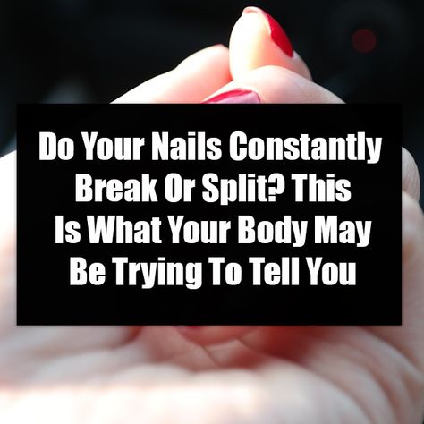 Split Nail Repair, Split Toenail, Big Nails, Nail Remedies, Split Nails, Weak Nails, Weak Hair, Nail Repair, Brittle Nails