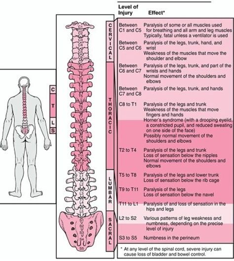 Effects of Spinal Injury Geriatric Occupational Therapy, Cauda Equina, Nerve Disorders, Spinal Nerve, Spinal Injury, Spine Health, Nursing Notes, Spinal Cord, Anatomy And Physiology